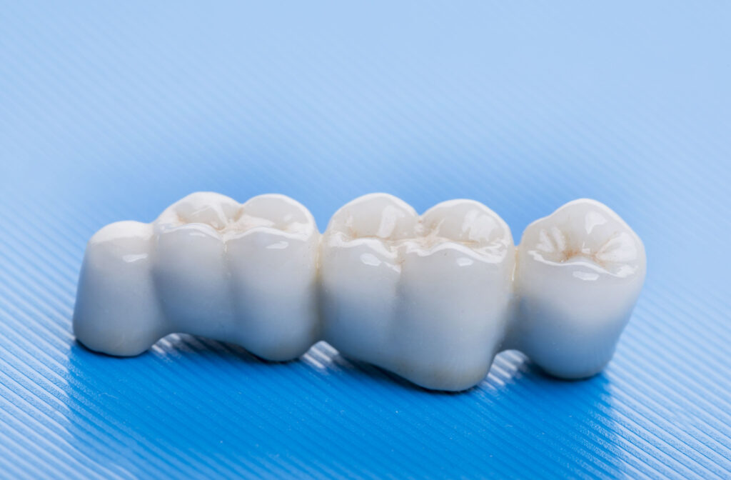 A ceramic dental bridge on a blue ribbed surface.