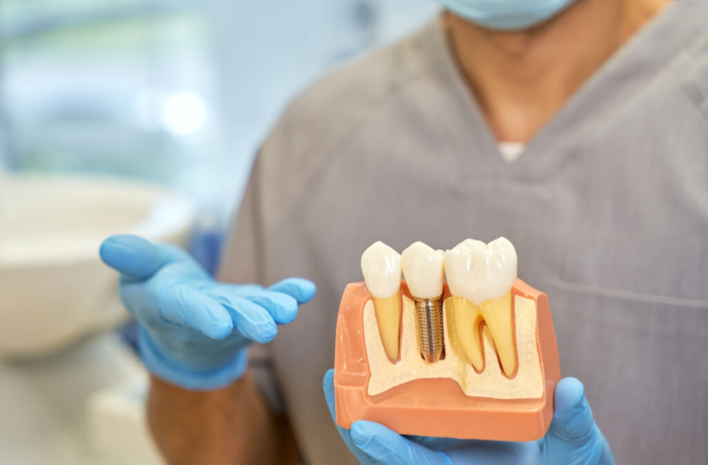 A dentist presenting a model of dental implant.