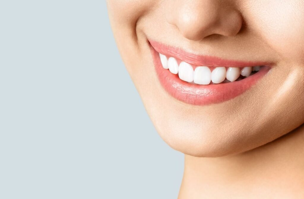 A woman smiling after teeth whitening