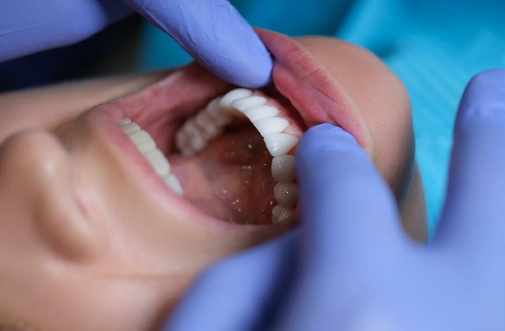 A close-up image of a dentist examining their patient's mouth for signs of vaping-related complications.