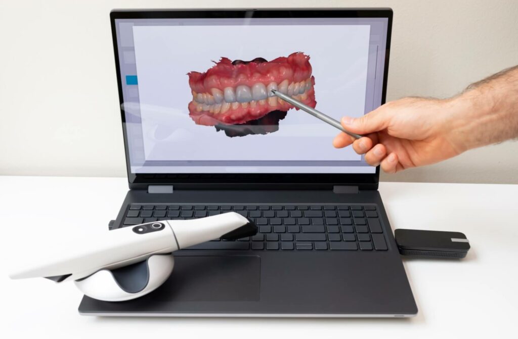 An open laptop displaying a digital teeth scan, scanner, and a dentist pointing at the screen.