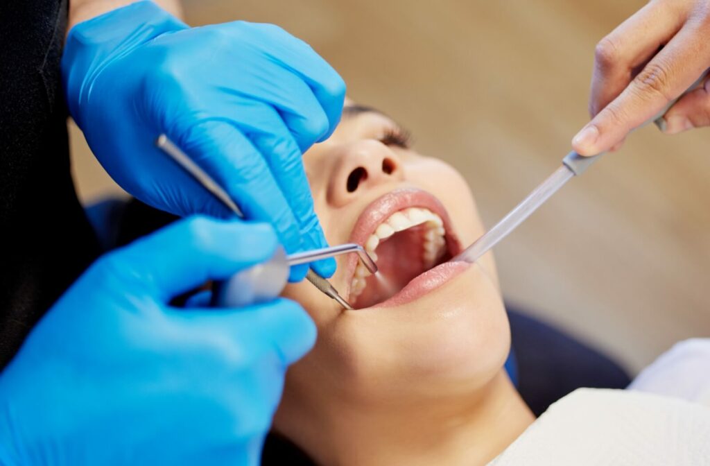 A gloved dentist carefully examining the mouth of a young adult with veneers and looking for cavities.