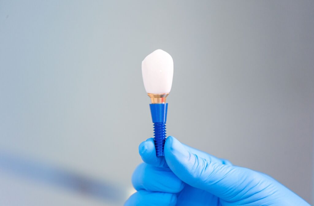 A dentist holds onto the abutment screw of a complete dental implant that is ready to be installed.