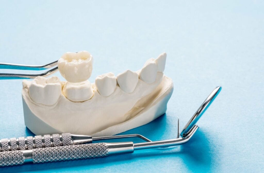 Shown is a dental crown on a model set of teeth.