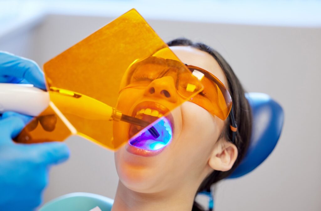 Patient wearing protective orange glasses during a dental filling procedure as a curing light is used to harden the composite material inside the mouth.
