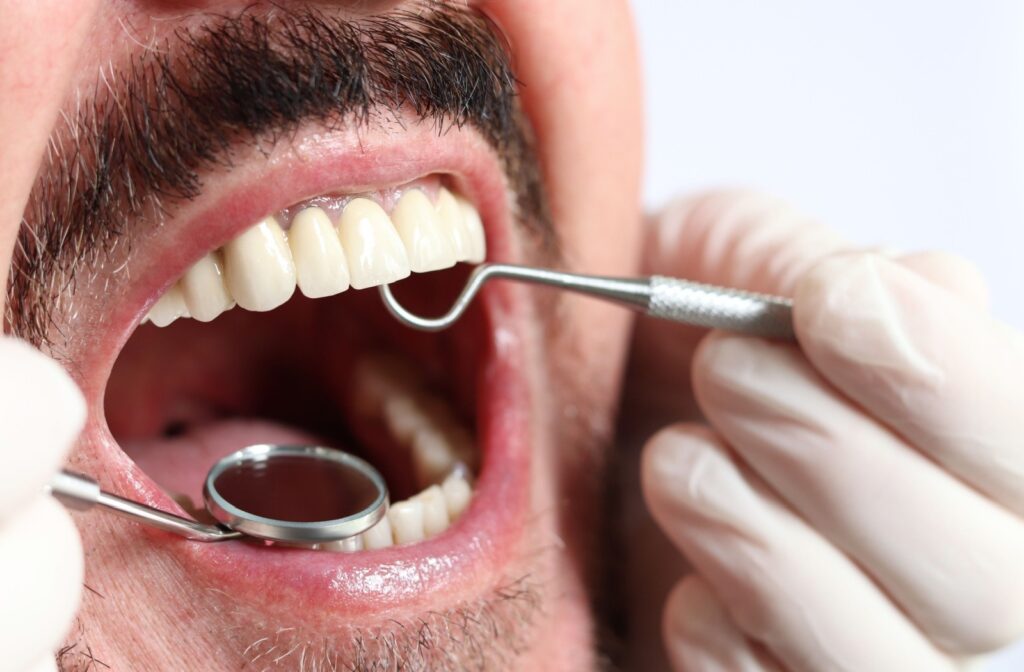 A close up of a mouth that is getting examined using dental equipment